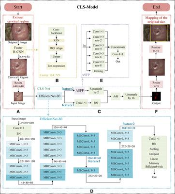 Segmentation of the cervical lesion region in colposcopic images based on deep learning